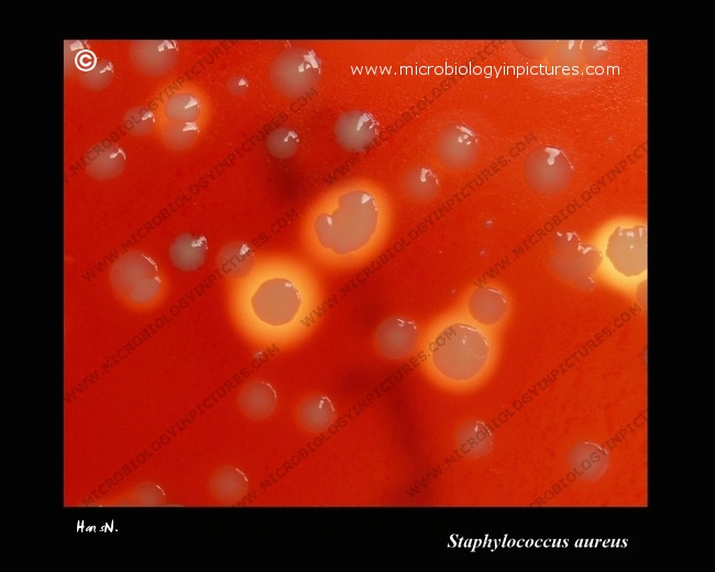 s.aureus beta-hemolysis